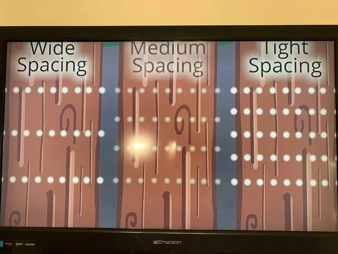 Christmas light spacing installation Kingwood TX